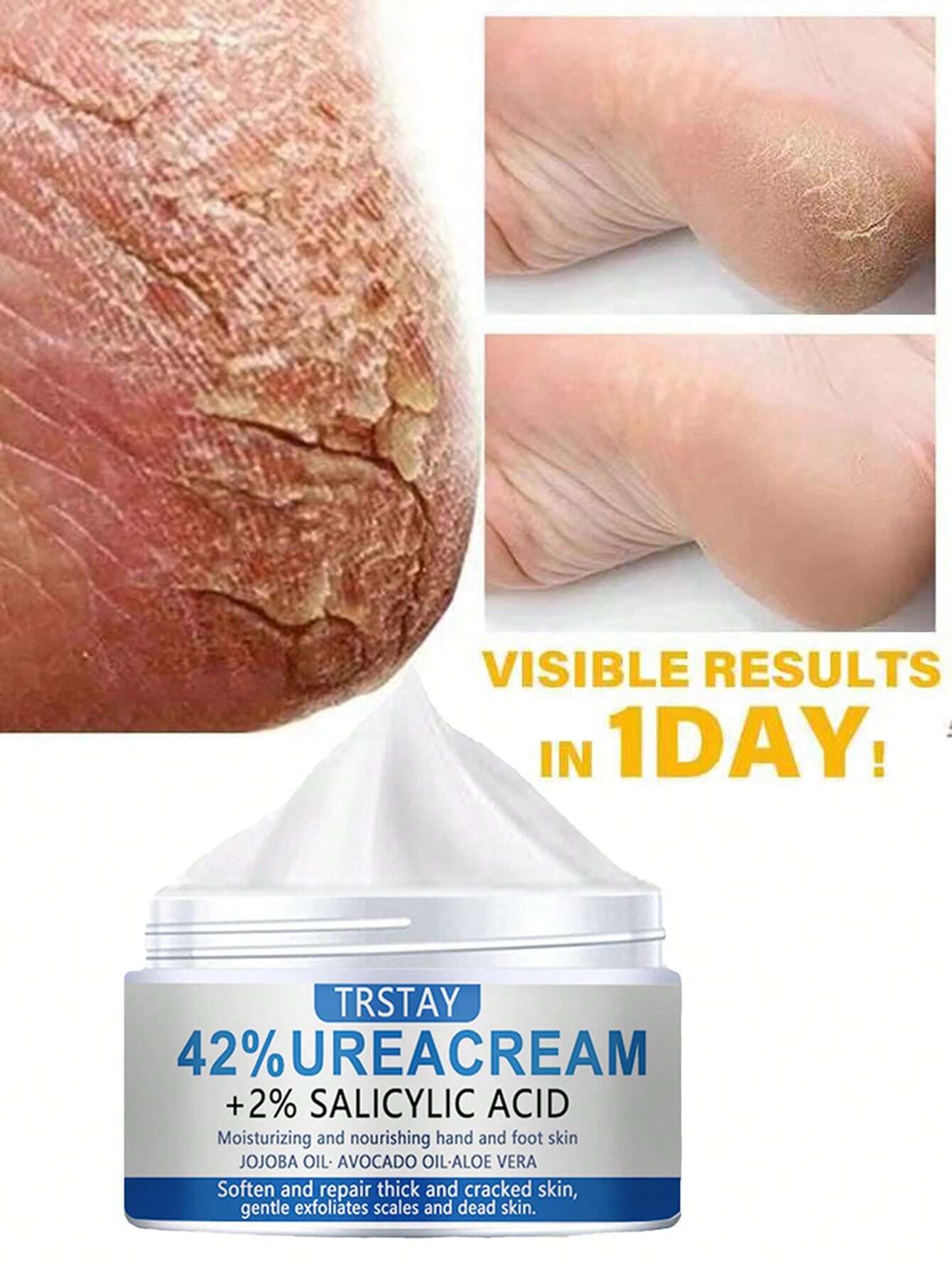 Moisturizing cream for dry skin, foot care, hand and foot repair cream