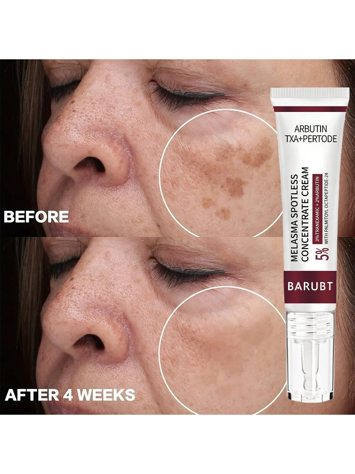 Youbuy Dragon's Blood Concentrate Skin Lightening & Melasma Prevention Cream, Removes Blemishes, Brown/Dark Spots, Pimples, Brightens Skin