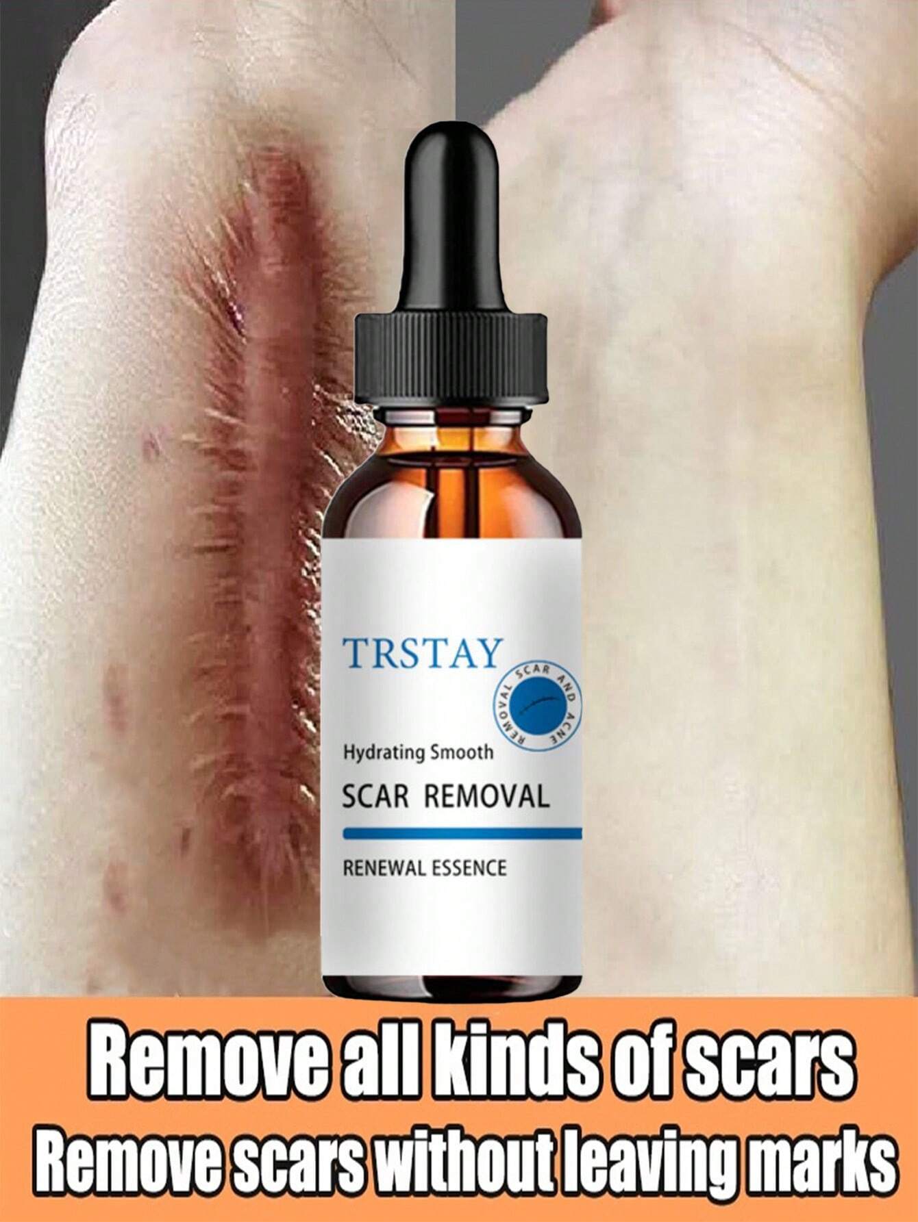 Scar Removal Moisturizer for Smooth Skin