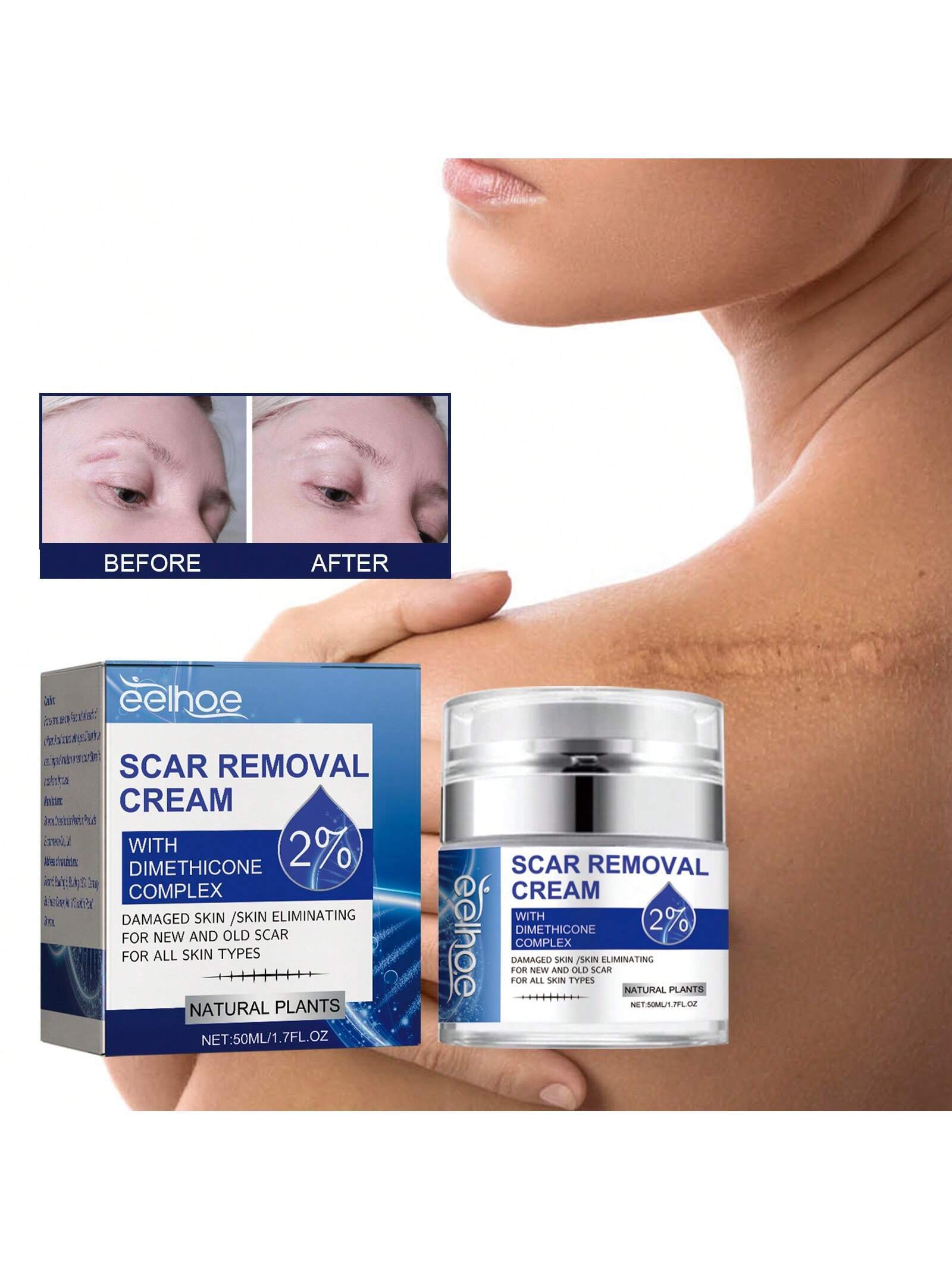 Scar Repair Cream 50ml Scar Lightening Skin Care Moisturizing Skin Care Cream.