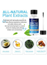 Skin Tag Remover