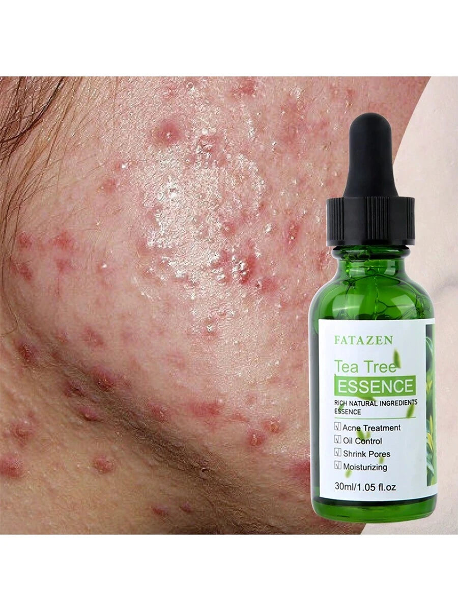 FATAZEN Organic Tea Tree Serum 30ml Natural Herbal Facial Care for Lightening Dark Spots, Softening Dry Sensitive Skin, Suitable for Anti-Aging, Wrinkles, Acne, Moisturizing and Anti-Oxidation