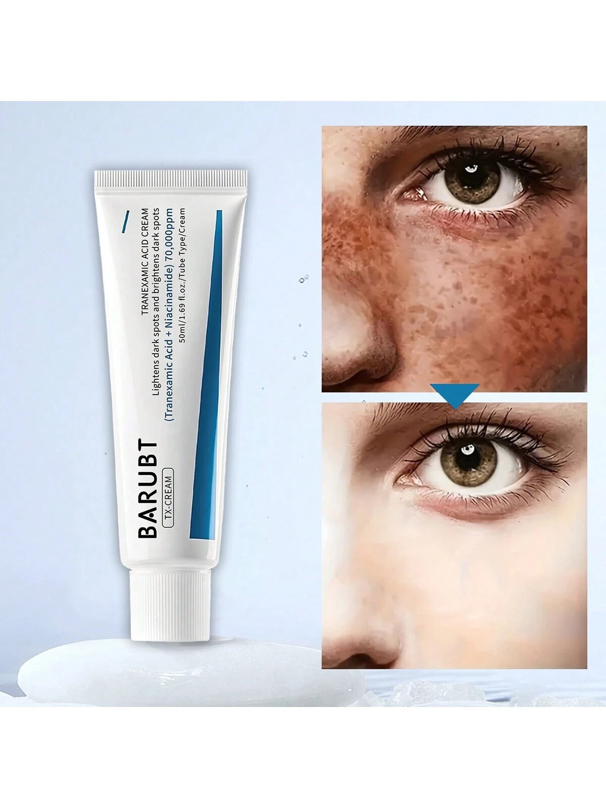 BARUBT Tranexamic Acid Cream 50ml, Removes Skin Spots, Freckles and Acne Marks, Leaves Skin Bright and Elastic